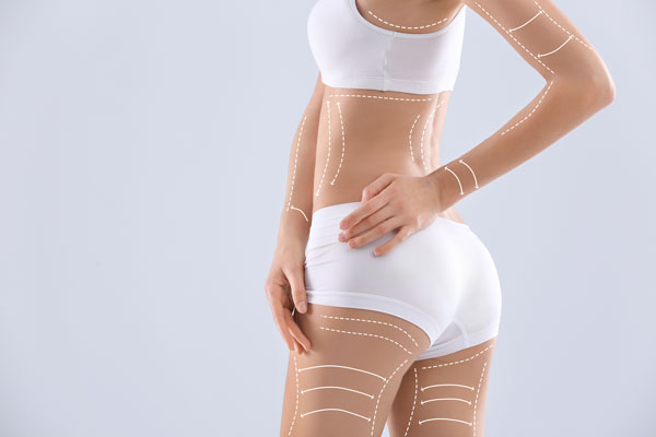 body
